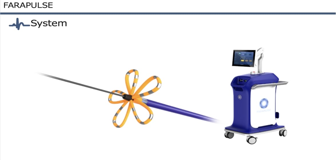 パルスフィールドアブレーションシステム