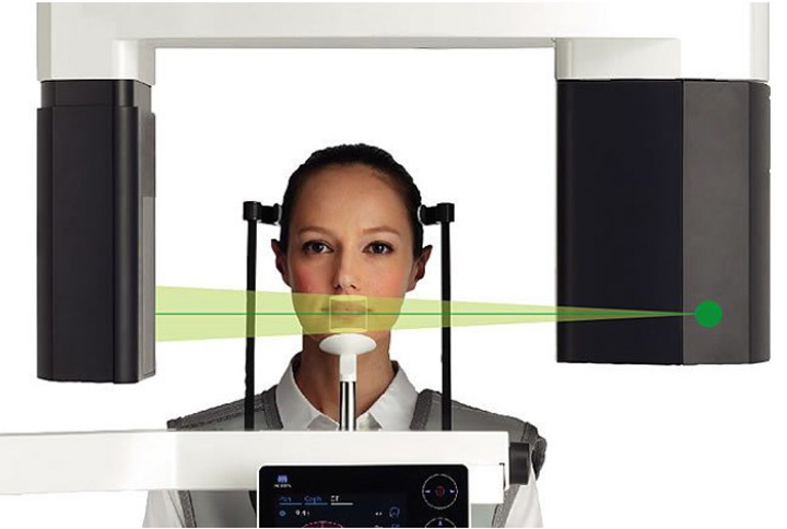 歯科撮影装置撮影イメージ