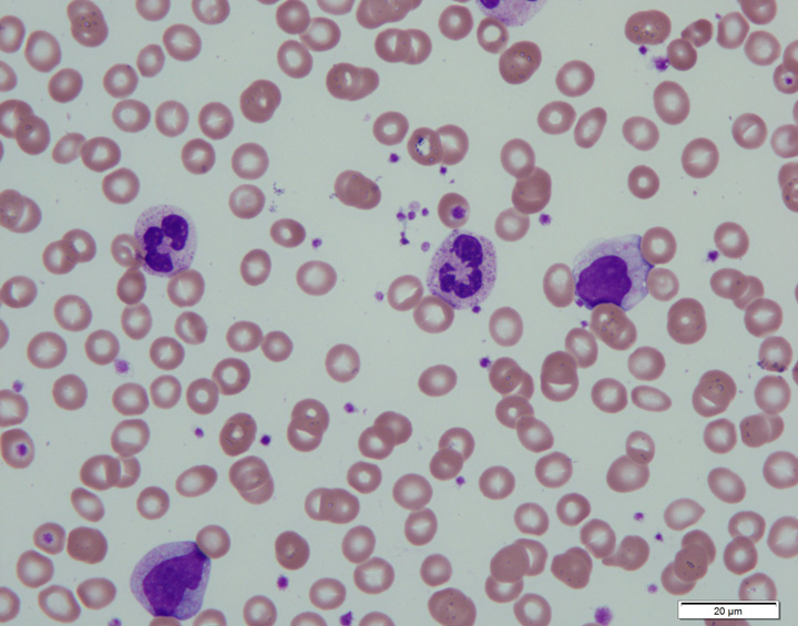 顕微鏡で見た血液像