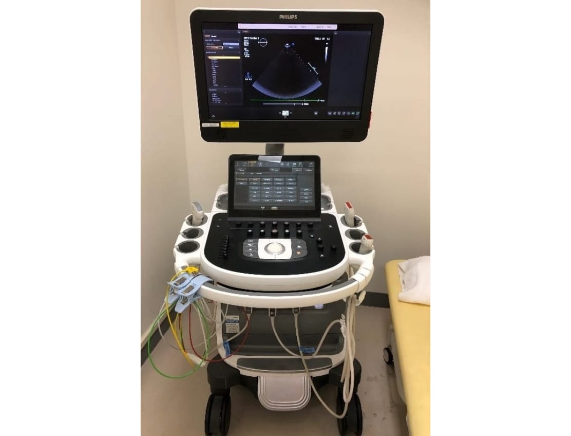 超音波診断装置（心臓用）