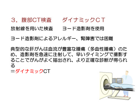 腹部CT検査 ダイナミックCT